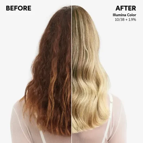 illumina 10/38 before and after